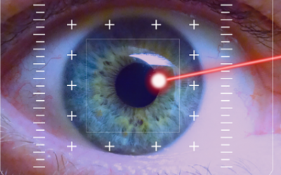 How Does LASIK and PRK surgery Work?