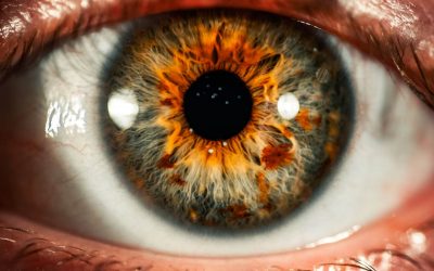 What is a Retinal Vein Occlusion and How is it Treated?