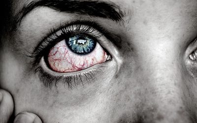 What is Bacterial Conjunctivitis (Pink Eye) and How is it Treated?