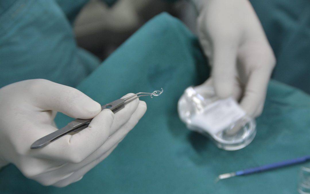 What Is a Multifocal IOL Lens?