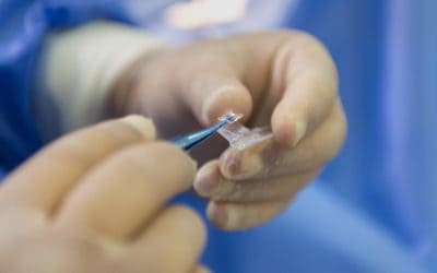 What is Toric IOL Cataract Surgery?